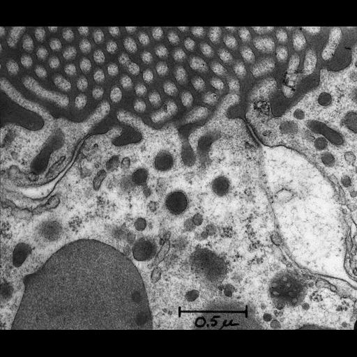  NCBI Organism:Rattus rattus; Cell Types:epithelial cell, ; Cell Components:zonula adherens, occluding junction, clathrin-coated endocytic vesicle, lysosome, endosome, brush border membrane, microvillus;