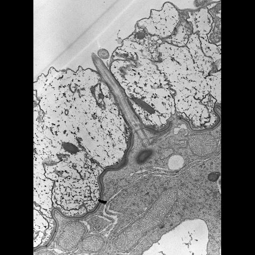  NCBI Organism:Nassula; Cell Types:cell by organism, eukaryotic cell, , ; Cell Components:plasma membrane, microtubule basal body, cell cortex; Biological process:plasma membrane organization, microtubule cytoskeleton organization, ciliary or flagellar motility, cortical cytoskeleton organization;