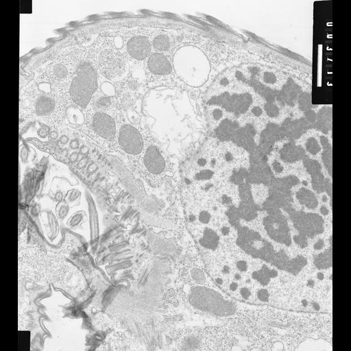  NCBI Organism:Opercularia [NCBITaxon:168247], , ; Cell Types:cell by organism, eukaryotic cell, , ; Cell Components:macronucleus, rough endoplasmic reticulum, myofibril, nuclear membrane, nuclear pore; Biological process:nuclear membrane organization, skeletal myofibril assembly, ;