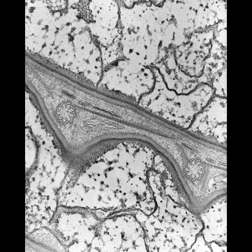  NCBI Organism:Nassula; Cell Types:cell by organism, eukaryotic cell, , ; Cell Components:microtubule basal body, cytoskeleton; Biological process:cortical cytoskeleton organization, ciliary or flagellar motility;