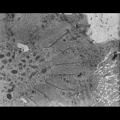  NCBI Organism:Nassula; Cell Types:cell by organism, eukaryotic cell, , ; Cell Components:oral apparatus, microtubule; Biological process:oral apparatus organization, microtubule bundle formation;