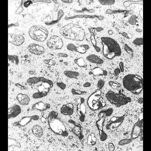  NCBI Organism:Nassula; Cell Types:cell by organism, eukaryotic cell, , ; Cell Components:cytoplasm, vesicle membrane; Biological process:cytoplasm organization, ;