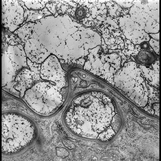  NCBI Organism:Nassula; Cell Types:cell by organism, eukaryotic cell, , ; Cell Components:cell cortex, clathrin coat, ; Biological process:cortical cytoskeleton organization, microtubule cytoskeleton organization, clathrin coat assembly;