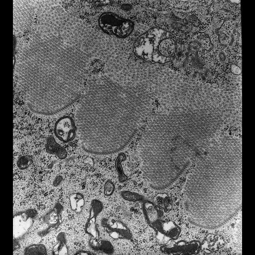  NCBI Organism:Nassula; Cell Types:cell by organism, eukaryotic cell, , ; Cell Components:oral apparatus, microtubule associated complex; Biological process:oral apparatus organization, microtubule bundle formation;