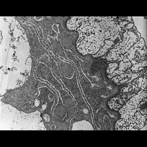  NCBI Organism:Nassula; Cell Types:cell by organism, eukaryotic cell, , ; Cell Components:endoplasmic reticulum membrane, plasma membrane, , ; Biological process:endoplasmic reticulum organization, , ;