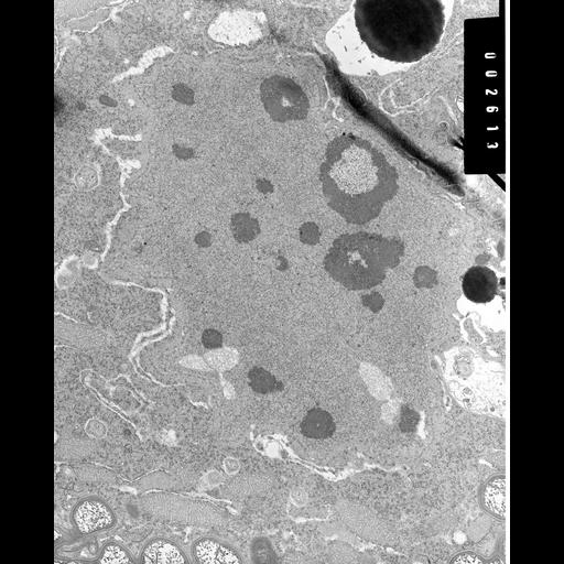  NCBI Organism:Nassula; Cell Types:cell by organism, eukaryotic cell, , ; Cell Components:macronucleus, nucleolus, nucleolus organizer region; Biological process:macronucleus organization, nucleolus organization, nucleolus to nucleoplasm transport;