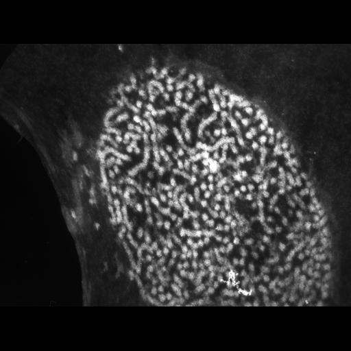  NCBI Organism:Patiria miniata; Cell Types:sperm Cell Components:nuclear chromatin Biological process:fertilization, nucleus organization, chromatin organization;