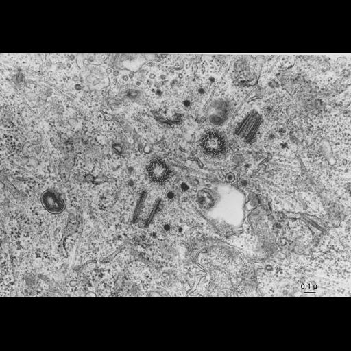  NCBI Organism:Cricetulus griseus; Cell Types:primary cell line cell, fibroblast; Cell Components:centriole, centrosome, microtubule; Biological process:mitosis