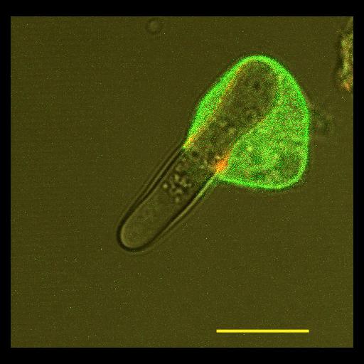  NCBI Organism:Dictyostelium discoideum; Cell Types:cell by organism, eukaryotic cell, , amoeboid cell; Cell Components:phagocytic vesicle, food vacuole; Biological process:, , digestion, response to food;