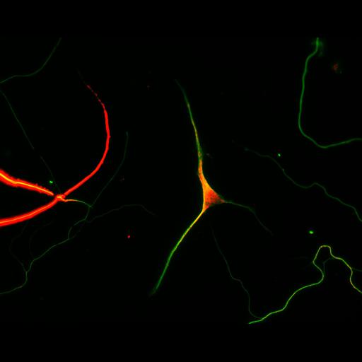  NCBI Organism:Rattus; Cell Types:multipolar neuron Cell Components:cytoskeleton, microtubule cytoskeleton, axon, dendrite; Biological process:cellular developmental process, dendrite development, establishment or maintenance of cell polarity;