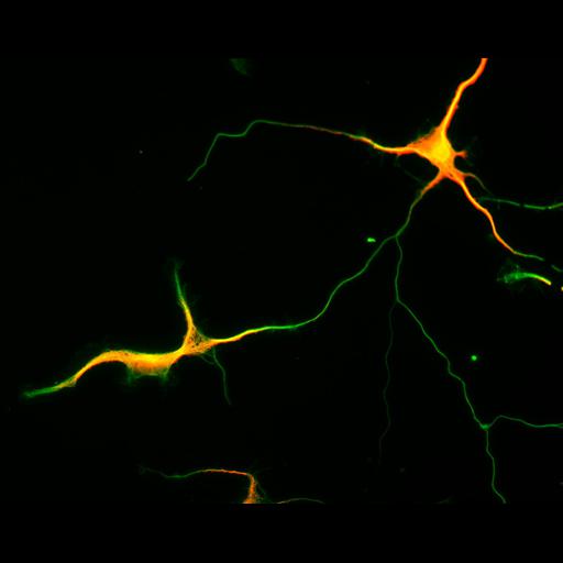  NCBI Organism:Rattus; Cell Types:multipolar neuron Cell Components:cytoskeleton, microtubule cytoskeleton, axon, dendrite; Biological process:cellular developmental process, dendrite development, establishment or maintenance of cell polarity;