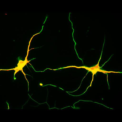  NCBI Organism:Rattus; Cell Types:multipolar neuron Cell Components:cytoskeleton, microtubule cytoskeleton, axon, dendrite; Biological process:cellular developmental process, dendrite development, establishment or maintenance of cell polarity;