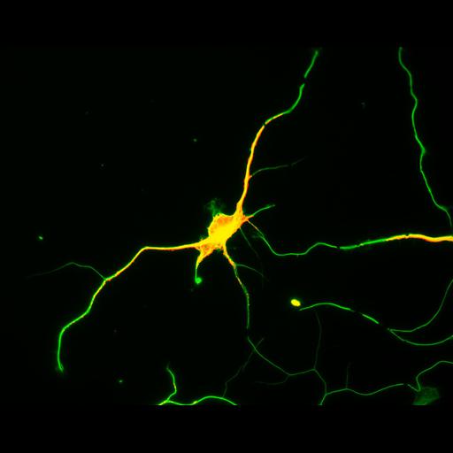  NCBI Organism:Rattus; Cell Types:multipolar neuron Cell Components:cytoskeleton, microtubule cytoskeleton, axon, dendrite; Biological process:cellular developmental process, dendrite development, establishment or maintenance of cell polarity;