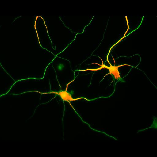  NCBI Organism:Rattus; Cell Types:multipolar neuron Cell Components:cytoskeleton, microtubule cytoskeleton, axon, dendrite; Biological process:cellular developmental process, dendrite development, establishment or maintenance of cell polarity;