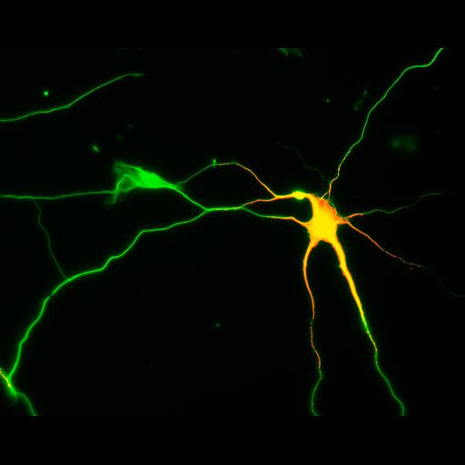  NCBI Organism:Rattus; Cell Types:multipolar neuron Cell Components:cytoskeleton, microtubule cytoskeleton, axon, dendrite; Biological process:cellular developmental process, dendrite development, establishment or maintenance of cell polarity;