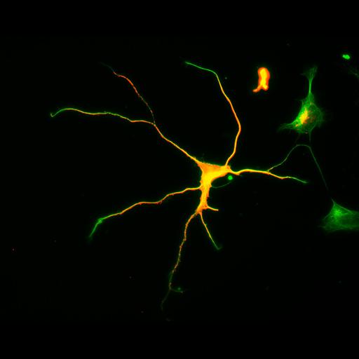  NCBI Organism:Rattus; Cell Types:multipolar neuron Cell Components:cytoskeleton, microtubule cytoskeleton, axon, dendrite; Biological process:cellular developmental process, dendrite development, establishment or maintenance of cell polarity;