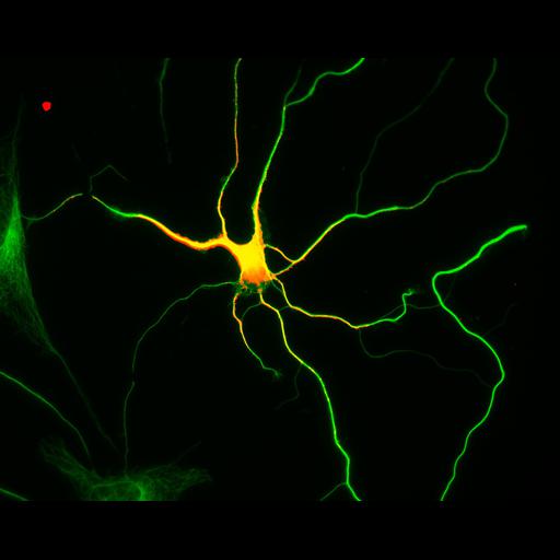  NCBI Organism:Rattus; Cell Types:multipolar neuron Cell Components:cytoskeleton, microtubule cytoskeleton, axon, dendrite; Biological process:cellular developmental process, dendrite development, establishment or maintenance of cell polarity;