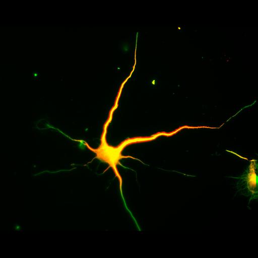  NCBI Organism:Rattus; Cell Types:multipolar neuron Cell Components:cytoskeleton, microtubule cytoskeleton, axon, dendrite; Biological process:cellular developmental process, dendrite development, establishment or maintenance of cell polarity;