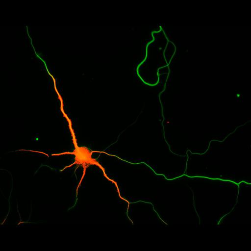  NCBI Organism:Rattus; Cell Types:multipolar neuron Cell Components:cytoskeleton, microtubule cytoskeleton, axon, dendrite; Biological process:cellular developmental process, dendrite development, establishment or maintenance of cell polarity;