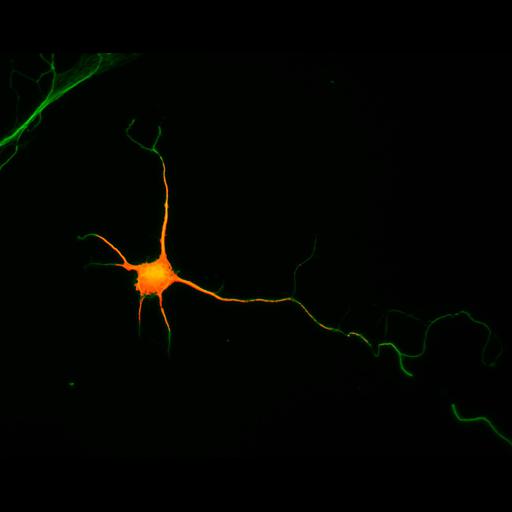  NCBI Organism:Rattus; Cell Types:multipolar neuron Cell Components:cytoskeleton, microtubule cytoskeleton, axon, dendrite; Biological process:cellular developmental process, dendrite development, establishment or maintenance of cell polarity;