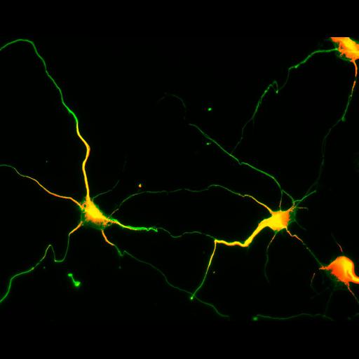  NCBI Organism:Rattus; Cell Types:multipolar neuron Cell Components:cytoskeleton, microtubule cytoskeleton, axon, dendrite; Biological process:cellular developmental process, dendrite development, establishment or maintenance of cell polarity;