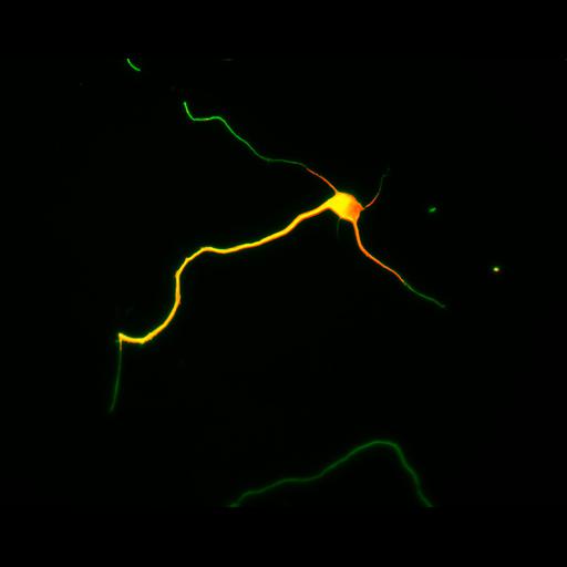  NCBI Organism:Rattus; Cell Types:multipolar neuron Cell Components:cytoskeleton, microtubule cytoskeleton, axon, dendrite; Biological process:cellular developmental process, dendrite development, establishment or maintenance of cell polarity;