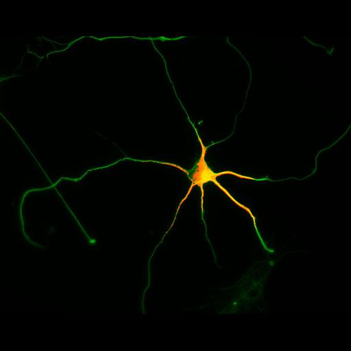  NCBI Organism:Rattus; Cell Types:multipolar neuron Cell Components:cytoskeleton, microtubule cytoskeleton, axon, dendrite; Biological process:cellular developmental process, dendrite development, establishment or maintenance of cell polarity;