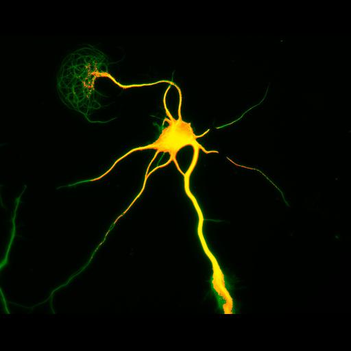  NCBI Organism:Rattus; Cell Types:multipolar neuron Cell Components:cytoskeleton, microtubule cytoskeleton, axon, dendrite; Biological process:cellular developmental process, dendrite development, establishment or maintenance of cell polarity;