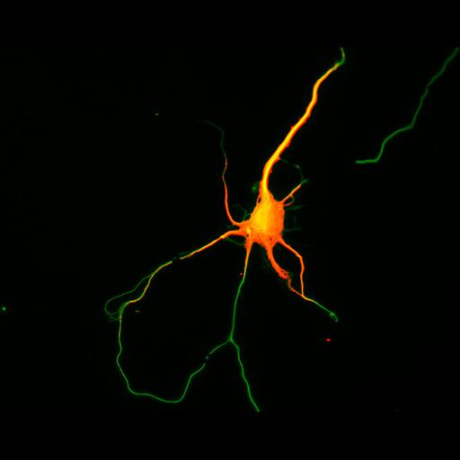  NCBI Organism:Rattus; Cell Types:multipolar neuron Cell Components:cytoskeleton, microtubule cytoskeleton, axon, dendrite; Biological process:cellular developmental process, dendrite development, establishment or maintenance of cell polarity;