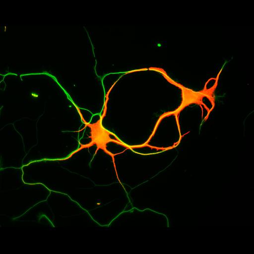  NCBI Organism:Rattus; Cell Types:multipolar neuron Cell Components:cytoskeleton, microtubule cytoskeleton, axon, dendrite; Biological process:cellular developmental process, dendrite development, establishment or maintenance of cell polarity;