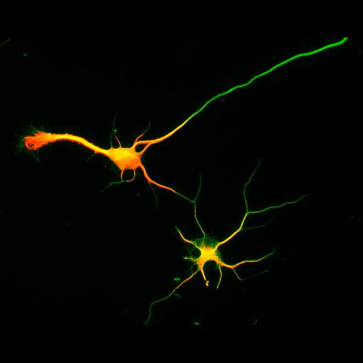  NCBI Organism:Rattus; Cell Types:multipolar neuron Cell Components:cytoskeleton, microtubule cytoskeleton, axon, dendrite; Biological process:cellular developmental process, dendrite development, establishment or maintenance of cell polarity;