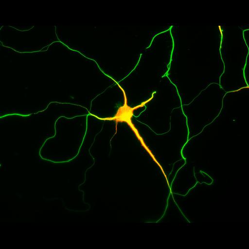  NCBI Organism:Rattus; Cell Types:multipolar neuron Cell Components:cytoskeleton, microtubule cytoskeleton, axon, dendrite; Biological process:cellular developmental process, dendrite development, establishment or maintenance of cell polarity;