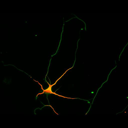  NCBI Organism:Rattus; Cell Types:multipolar neuron Cell Components:cytoskeleton, microtubule cytoskeleton, axon, dendrite; Biological process:cellular developmental process, dendrite development, establishment or maintenance of cell polarity;