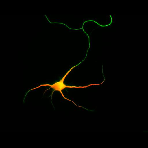  NCBI Organism:Rattus; Cell Types:multipolar neuron Cell Components:cytoskeleton, microtubule cytoskeleton, axon, dendrite; Biological process:cellular developmental process, dendrite development, establishment or maintenance of cell polarity;