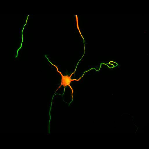  NCBI Organism:Rattus; Cell Types:multipolar neuron Cell Components:cytoskeleton, microtubule cytoskeleton, axon, dendrite; Biological process:cellular developmental process, dendrite development, establishment or maintenance of cell polarity;