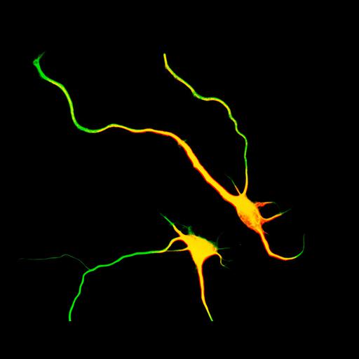  NCBI Organism:Rattus; Cell Types:multipolar neuron Cell Components:cytoskeleton, microtubule cytoskeleton, axon, dendrite; Biological process:cellular developmental process, dendrite development, establishment or maintenance of cell polarity;