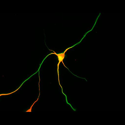  NCBI Organism:Rattus; Cell Types:multipolar neuron Cell Components:cytoskeleton, microtubule cytoskeleton, axon, dendrite; Biological process:cellular developmental process, dendrite development, establishment or maintenance of cell polarity;