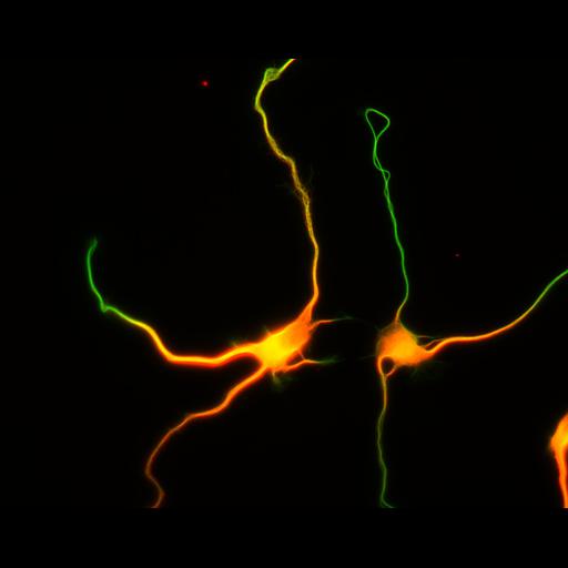  NCBI Organism:Rattus; Cell Types:multipolar neuron Cell Components:cytoskeleton, microtubule cytoskeleton, axon, dendrite; Biological process:cellular developmental process, dendrite development, establishment or maintenance of cell polarity;