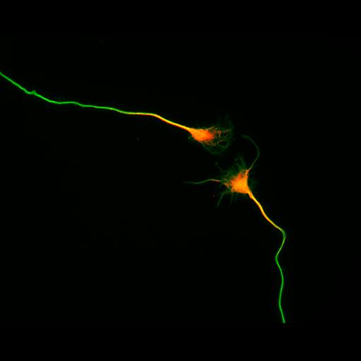  NCBI Organism:Rattus; Cell Types:multipolar neuron Cell Components:cytoskeleton, microtubule cytoskeleton, axon, dendrite; Biological process:cellular developmental process, dendrite development, establishment or maintenance of cell polarity;