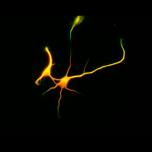  NCBI Organism:Rattus; Cell Types:multipolar neuron Cell Components:cytoskeleton, microtubule cytoskeleton, axon, dendrite; Biological process:cellular developmental process, dendrite development, establishment or maintenance of cell polarity;