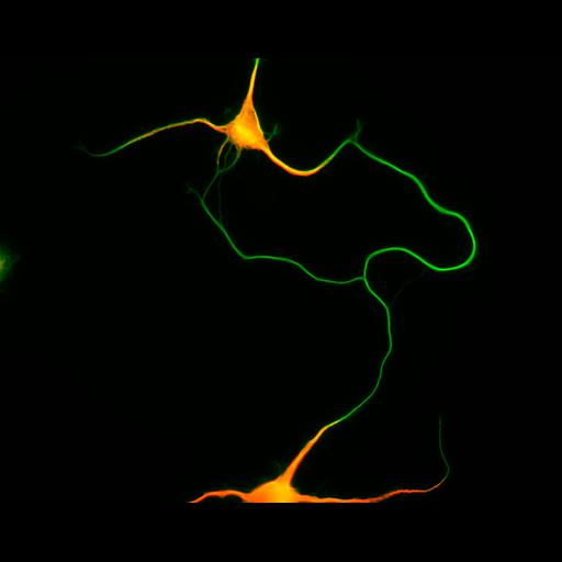  NCBI Organism:Rattus; Cell Types:multipolar neuron Cell Components:cytoskeleton, microtubule cytoskeleton, axon, dendrite; Biological process:cellular developmental process, dendrite development, establishment or maintenance of cell polarity;