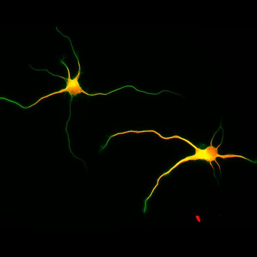  NCBI Organism:Rattus; Cell Types:multipolar neuron Cell Components:cytoskeleton, microtubule cytoskeleton, axon, dendrite; Biological process:cellular developmental process, dendrite development, establishment or maintenance of cell polarity;