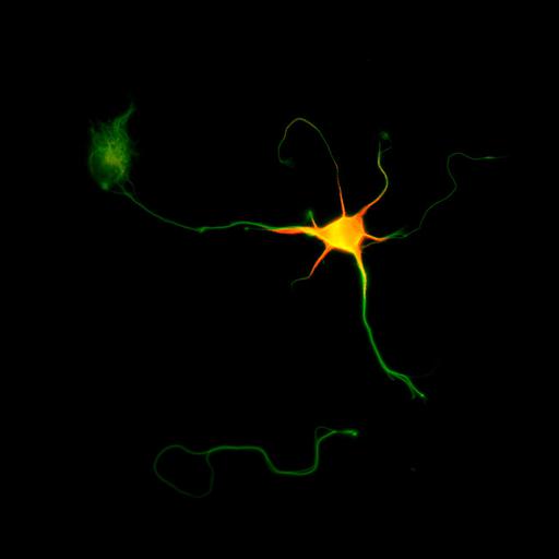  NCBI Organism:Rattus; Cell Types:multipolar neuron Cell Components:cytoskeleton, microtubule cytoskeleton, axon, dendrite; Biological process:cellular developmental process, dendrite development, establishment or maintenance of cell polarity;