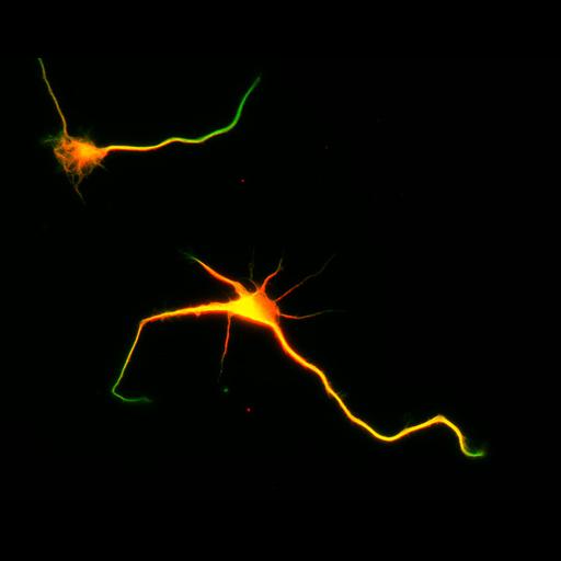  NCBI Organism:Rattus; Cell Types:multipolar neuron Cell Components:cytoskeleton, microtubule cytoskeleton, axon, dendrite; Biological process:cellular developmental process, dendrite development, establishment or maintenance of cell polarity;