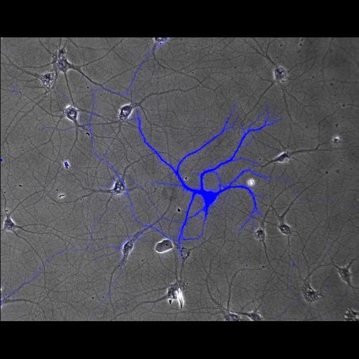  NCBI Organism:Rattus; Cell Types:, multipolar neuron; Cell Components:axon, dendrite, neuron spine; Biological process:cellular developmental process, establishment or maintenance of cell polarity, dendrite development;