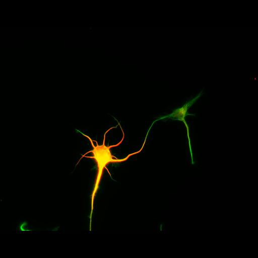  NCBI Organism:Rattus; Cell Types:multipolar neuron Cell Components:cytoskeleton, microtubule cytoskeleton, axon, dendrite; Biological process:cellular developmental process, dendrite development, establishment or maintenance of cell polarity;