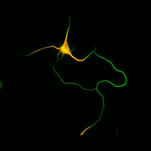  NCBI Organism:Rattus; Cell Types:multipolar neuron Cell Components:cytoskeleton, microtubule cytoskeleton, axon, dendrite; Biological process:cellular developmental process, dendrite development, establishment or maintenance of cell polarity;