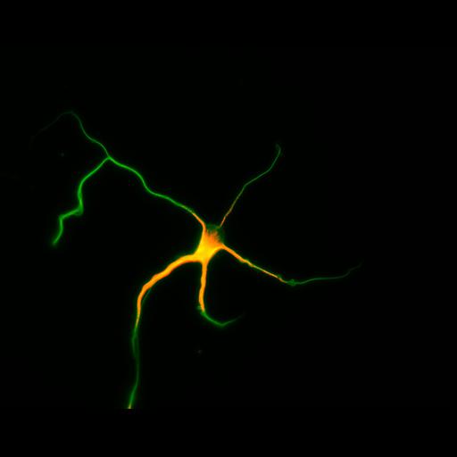  NCBI Organism:Rattus; Cell Types:multipolar neuron Cell Components:cytoskeleton, microtubule cytoskeleton, axon, dendrite; Biological process:cellular developmental process, dendrite development, establishment or maintenance of cell polarity;