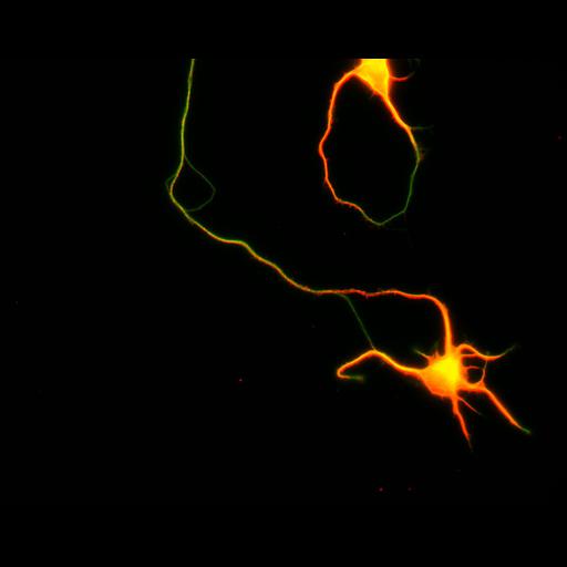  NCBI Organism:Rattus; Cell Types:multipolar neuron Cell Components:cytoskeleton, microtubule cytoskeleton, axon, dendrite; Biological process:cellular developmental process, dendrite development, establishment or maintenance of cell polarity;