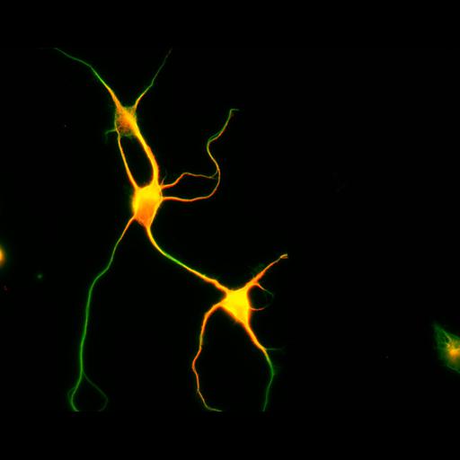  NCBI Organism:Rattus; Cell Types:multipolar neuron Cell Components:cytoskeleton, microtubule cytoskeleton, axon, dendrite; Biological process:cellular developmental process, dendrite development, establishment or maintenance of cell polarity;